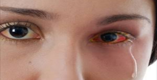 
	தமிழக மக்களே கவனமா இருங்க.. அடுத்து பரவுகிறது கண் தொற்று பாதிப்பு.! - Seithipunal
