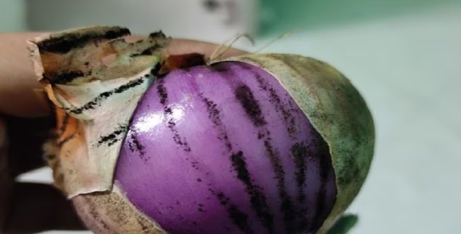 
	வெங்காயத்தில் கருப்பு திட்டு — அதை பயன்படுத்துவது பாதுகாப்பானதா? சாப்பிடலாமா? மருத்துவர் எச்சரிக்கை! - Seithipunal
