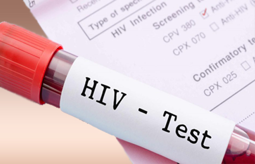 hiv test,seithipunal