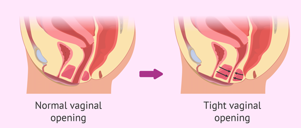 normal vagina opening, tight vagina opening, vagina, 