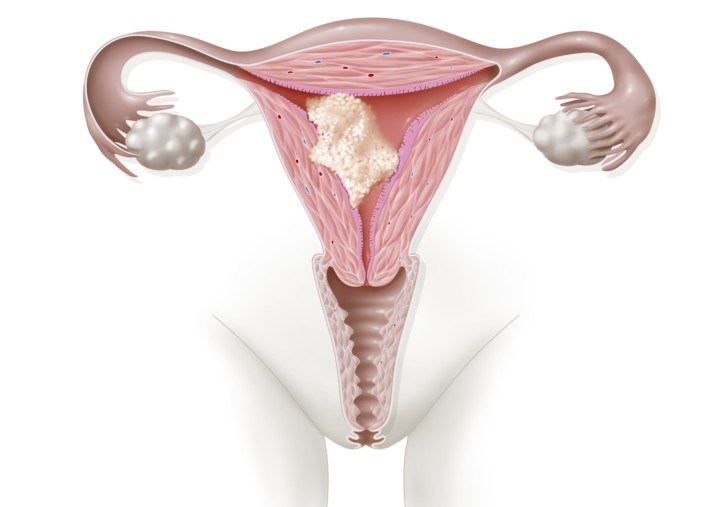 Yoni, yoni image, vagina, female reproductive system, uterus, குறுகிய யோனி, யோனி, 