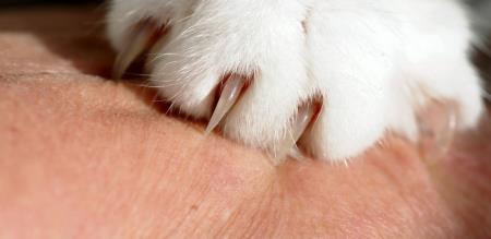 Shock in Kerala Little girl dies after being scratched by cats claw What happened