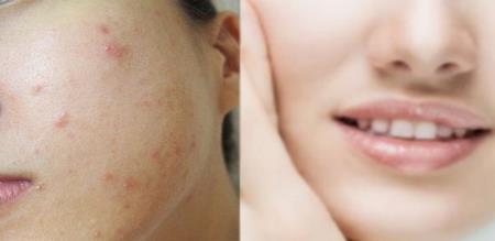 No one can say simpler way make scars disappear